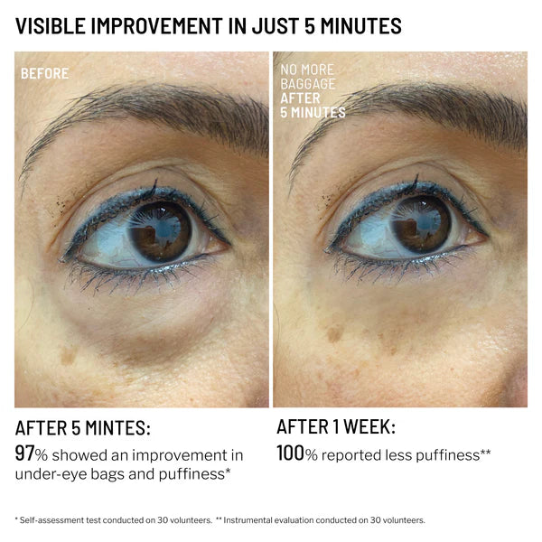No More Baggage Eye Bag Cream-Depuff, Tighten & Brighten Tired Under-Eyes in Just 5 Minutes
