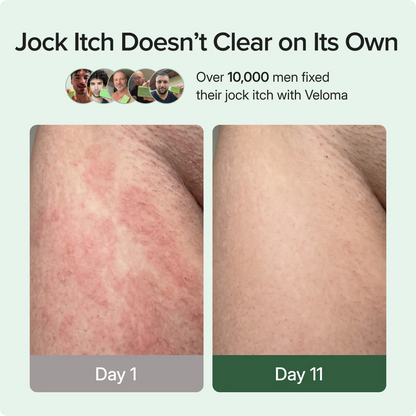 Veloma Antifungal Soap