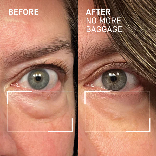 No More Baggage Eye Bag Cream-Depuff, Tighten & Brighten Tired Under-Eyes in Just 5 Minutes